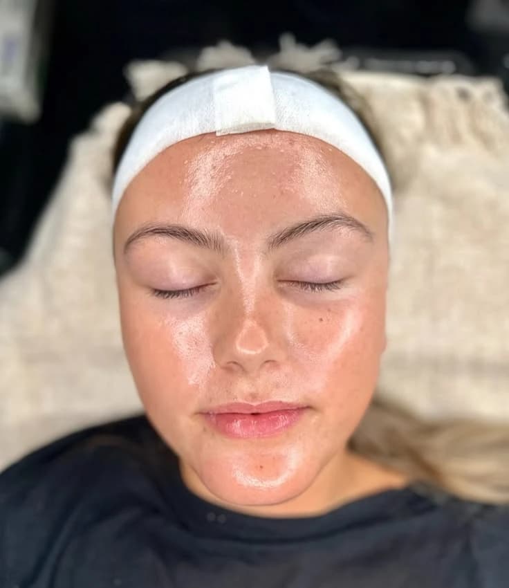 Hydrafacial in Islamabad: A Modern Facial Solution for Healthy, and Glowing Skin